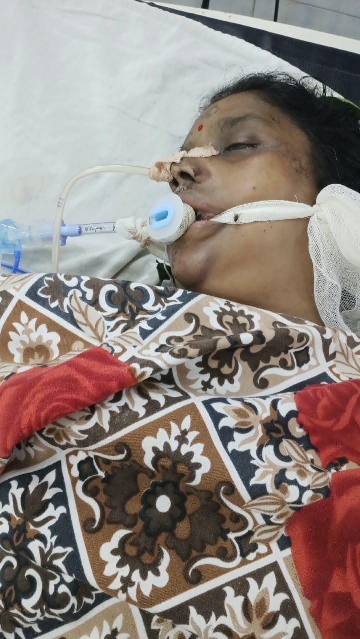 रीवा के संजय गांधी अस्पताल में फिर उठे सवाल, एक्सीडेंट के बाद भर्ती महिला की हालत बिगड़ी; परिजनों ने लगाए लापरवाही के आरोप